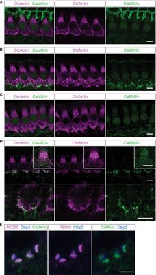 Activity-Dependent Phosphorylation by CaMKIIδ Alters the Ca2+ Affinity of the Multi-C2-Domain Protein Otoferlin